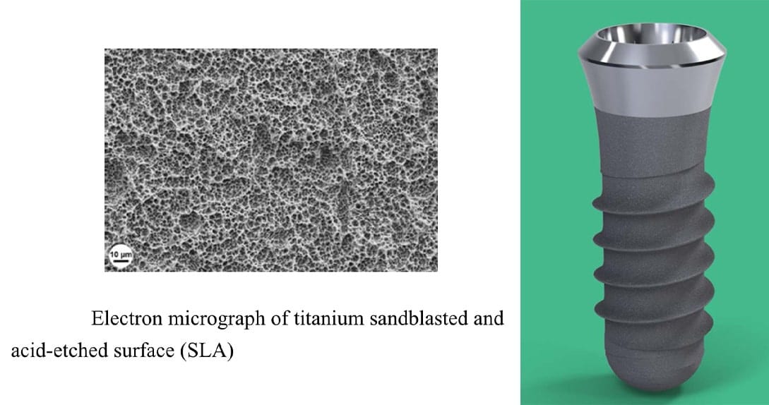 Electron-micrograph-of-titanium-sandblasted-and-acid-etched-surface updated