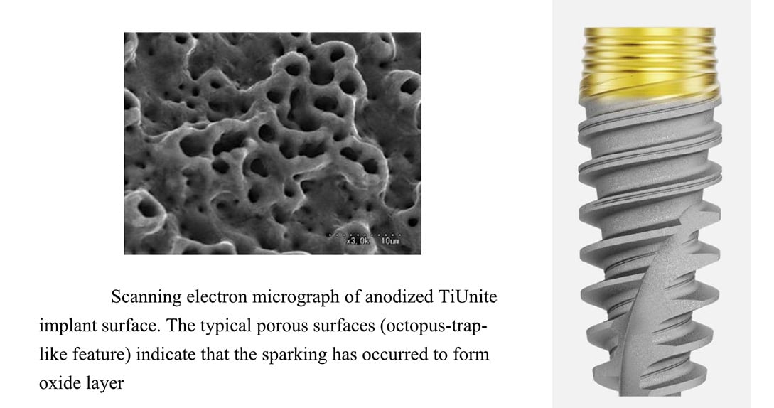 Scanning-electron-micrograph-anodized-tiunite-implant-surface updated