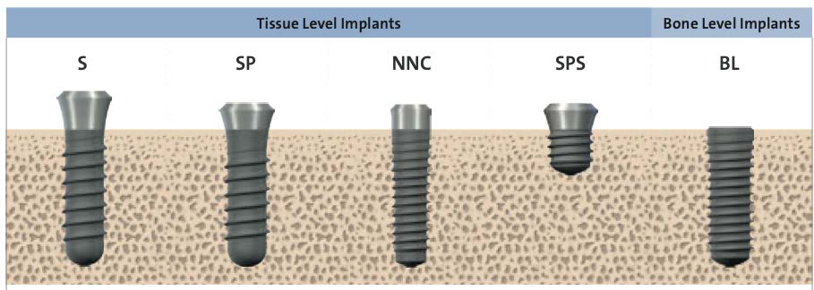 types of dental implants near hebron ct